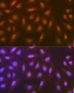 Syntenin 1 Recombinant Rabbit Monoclonal Antibody (3J5O6)
