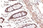 DDX17 Antibody in Immunohistochemistry (Paraffin) (IHC (P))