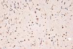 DDX17 Recombinant Rabbit Monoclonal Antibody (2U1P0)