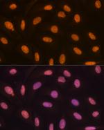 JMJD2B Recombinant Rabbit Monoclonal Antibody (8I0I1)