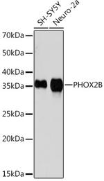 PHOX2B Recombinant Rabbit Monoclonal Antibody (4W5J8)