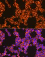Oncostatin M Recombinant Rabbit Monoclonal Antibody (8O8K9)