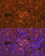 Oncostatin M Antibody in Immunohistochemistry (Paraffin) (IHC (P))