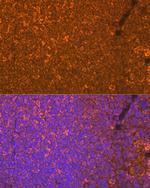 Oncostatin M Antibody in Immunohistochemistry (Paraffin) (IHC (P))