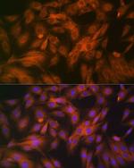 Calpain 1 Antibody in Immunocytochemistry (ICC/IF)