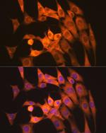 Calpain 1 Recombinant Rabbit Monoclonal Antibody (10E6O5)