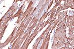 TPM1 Antibody in Immunohistochemistry (Paraffin) (IHC (P))