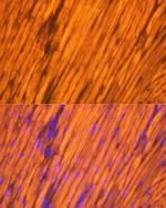 TPM1 Antibody in Immunohistochemistry (Paraffin) (IHC (P))