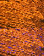 TPM1 Antibody in Immunohistochemistry (Paraffin) (IHC (P))