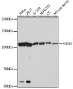 MSH2 Recombinant Rabbit Monoclonal Antibody (2L9I4)