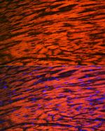 MYL2 Antibody in Immunohistochemistry (Paraffin) (IHC (P))