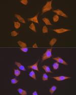 EEF1G Antibody in Immunocytochemistry (ICC/IF)