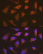CDKN2C Recombinant Rabbit Monoclonal Antibody (1Q10Q4)