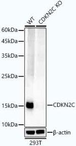CDKN2C Antibody in Western Blot (WB)