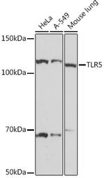 TLR5 Recombinant Rabbit Monoclonal Antibody (6P1Q10)