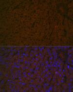 Haptoglobin Antibody in Immunohistochemistry (Paraffin) (IHC (P))
