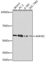 AMHR2 Recombinant Rabbit Monoclonal Antibody (8Z8X4)