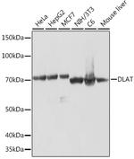 DLAT Recombinant Rabbit Monoclonal Antibody (2Z7R10)