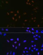 Bub3 Recombinant Rabbit Monoclonal Antibody (10G1S6)