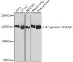 PLCG1 Recombinant Rabbit Monoclonal Antibody (6V9U10)