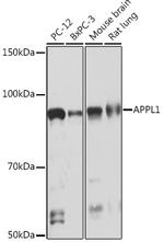 APPL1 Recombinant Rabbit Monoclonal Antibody (4M5X9)