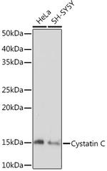 Cystatin C Recombinant Rabbit Monoclonal Antibody (0Z4G3)