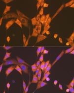 Raptor Recombinant Rabbit Monoclonal Antibody (9N0A4)