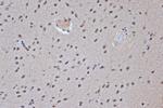 SRSF3 Antibody in Immunohistochemistry (Paraffin) (IHC (P))