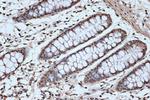 SRSF3 Antibody in Immunohistochemistry (Paraffin) (IHC (P))