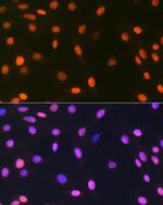 Histone Macro-H2A.1 Antibody in Immunocytochemistry (ICC/IF)