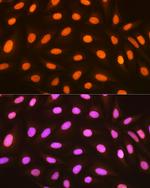 Histone Macro-H2A.1 Recombinant Rabbit Monoclonal Antibody (4D2O4)