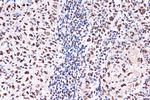 KHSRP Recombinant Rabbit Monoclonal Antibody (4V4O1)