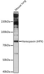 Hemopexin Antibody in Western Blot (WB)