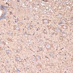 ABAT Antibody in Immunohistochemistry (Paraffin) (IHC (P))