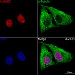 HMGB2 Recombinant Rabbit Monoclonal Antibody (8P10V5)