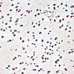 SET Antibody in Immunohistochemistry (Paraffin) (IHC (P))