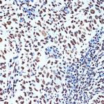 SET Antibody in Immunohistochemistry (Paraffin) (IHC (P))