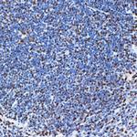 SET Antibody in Immunohistochemistry (Paraffin) (IHC (P))