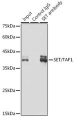 SET Antibody in Immunoprecipitation (IP)