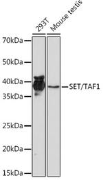SET Antibody in Western Blot (WB)