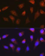 PSMA2 Recombinant Rabbit Monoclonal Antibody (6L5H4)