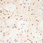 PSMA2 Antibody in Immunohistochemistry (Paraffin) (IHC (P))
