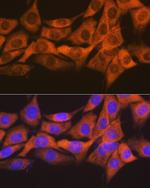 SOCS2 Recombinant Rabbit Monoclonal Antibody (6D3F6)