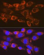 ARF1 Recombinant Rabbit Monoclonal Antibody (0C5B3)