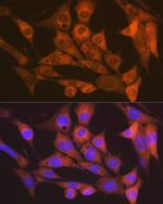 CaMKII delta Antibody in Immunocytochemistry (ICC/IF)