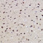 ABH1 Recombinant Rabbit Monoclonal Antibody (5K4W5)