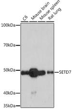 SETD7 Recombinant Rabbit Monoclonal Antibody (7Z6I8)