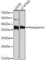 Podoplanin Recombinant Rabbit Monoclonal Antibody (8I3I5)