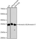 Annexin V Recombinant Rabbit Monoclonal Antibody (9A5M8)