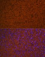 Hemoglobin alpha Antibody in Immunohistochemistry (Paraffin) (IHC (P))